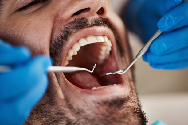Best Orthodontic Emergency Dentist in Elm Creek, TX