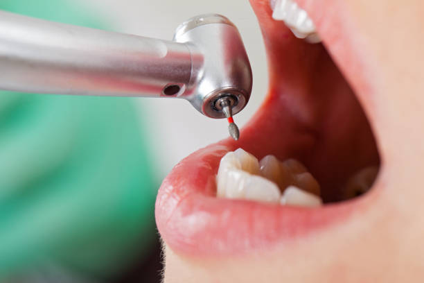 Best Pediatric Emergency Dentist in Elm Creek, TX